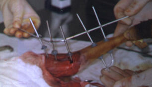 Redevet cirurgia fixação femur1