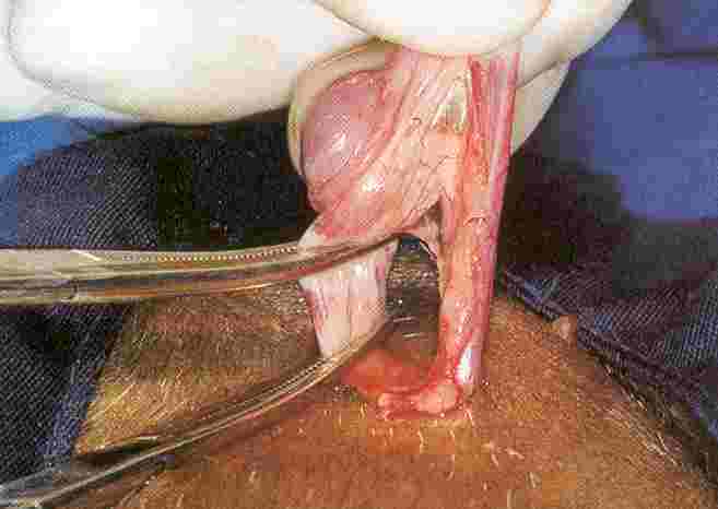 Redevet ovariosalpingo4